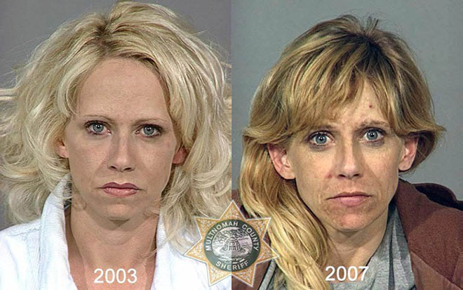 before-after-pics-drug-abusers13