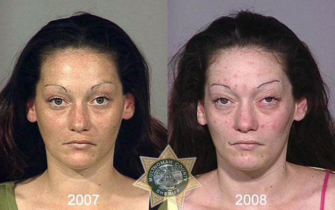 before-after-pics-drug-abusers14