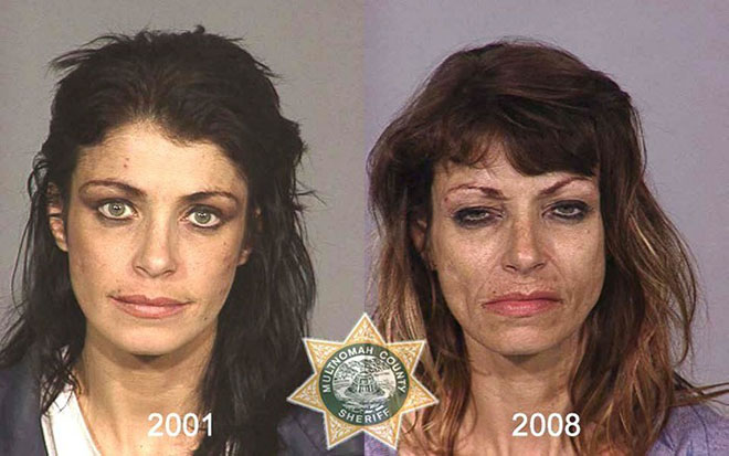 before-after-pics-drug-abusers2