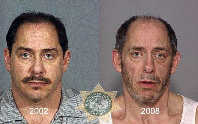 before-after-pics-drug-abusers20