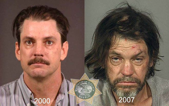 before-after-pics-drug-abusers3