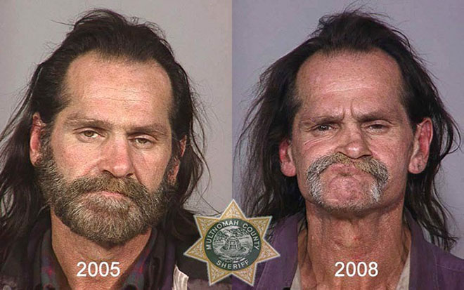 before-after-pics-drug-abusers4