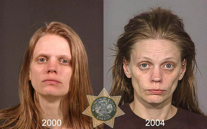 before-after-pics-drug-abusers6