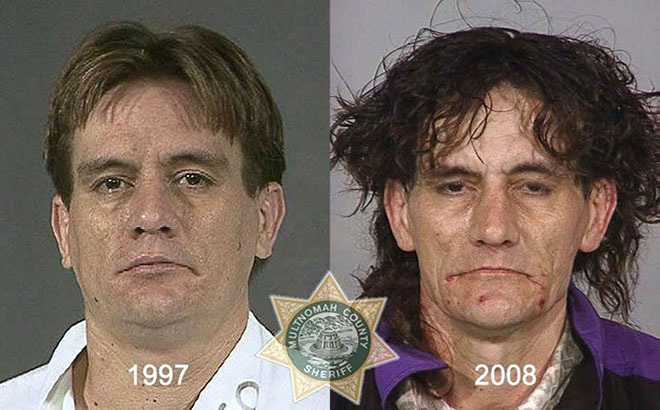 before-after-pics-drug-abusers7