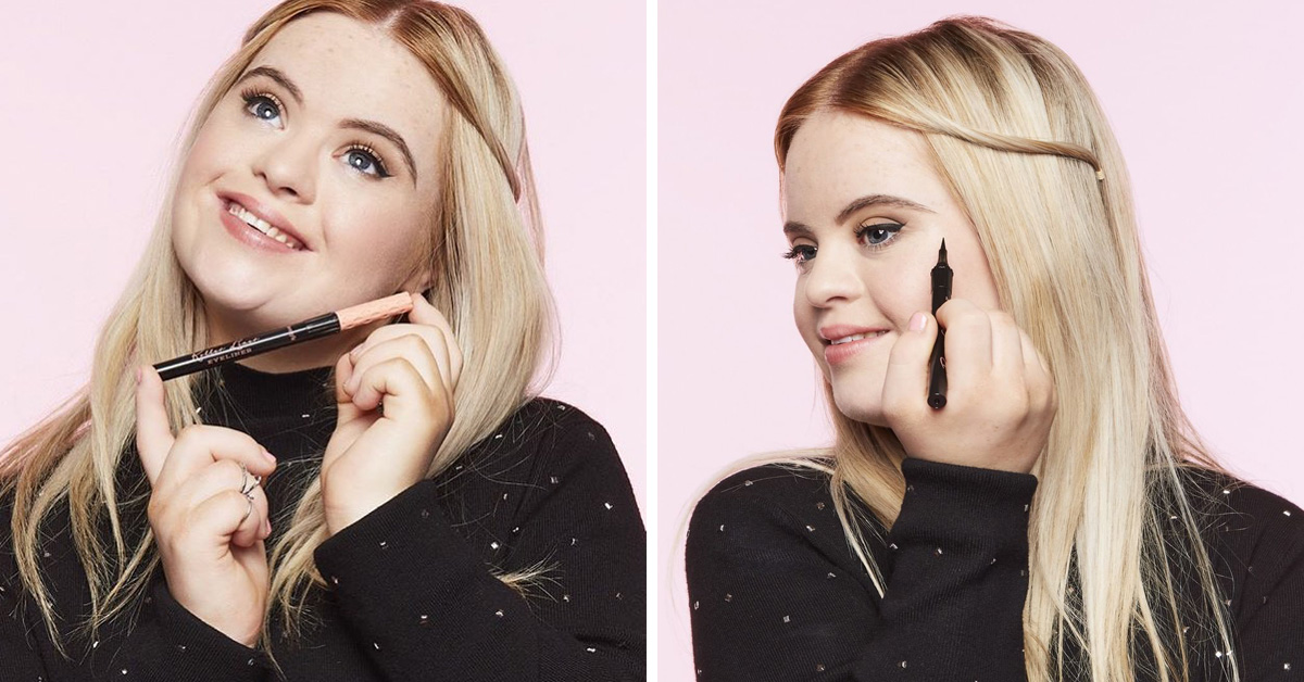 20YearOld Model With Down Syndrome Becomes The New Face Of Benefit