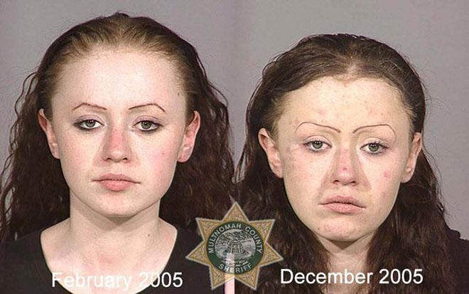 before-after-pics-drug-abusers17