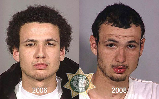 before-after-pics-drug-abusers21