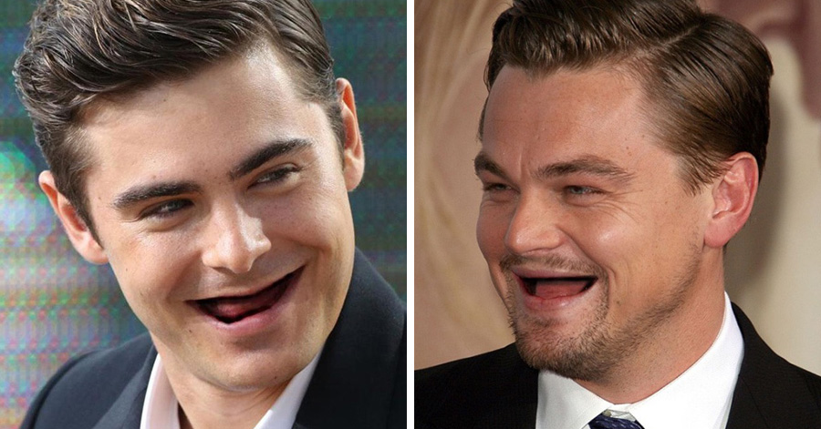 23 Hilarious Photos Of Celebrities Without Teeth. 