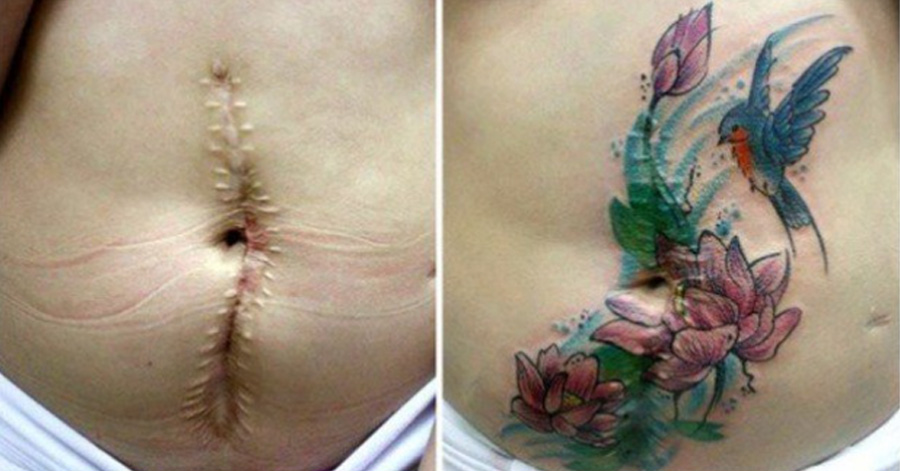 Tattoo Artist Is Doing Free Tattoos To Cover The Scars Of 
