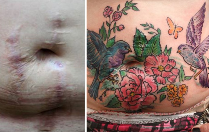 This Tattoo Artist Is Covering The Scars Of Domestic Violence Victims With Free Tattoos